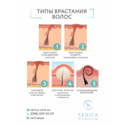 Інформаційний плакат, формат А3 "Типи вростання волосся" Serica Інформаційний плакат, формат А3 "Типи вростання волосся" Serica