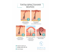 Плакат А4 "Типи вростання волосся", шт Плакат А4 "Типи вростання волосся", шт