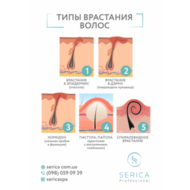Інформаційний плакат, формат А3 "Типи вростання волосся" Serica Інформаційний плакат, формат А3 "Типи вростання волосся" Serica